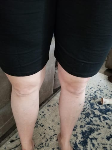Customer photo review of Emoswim - Damen Knielange Casual Baumwoll-Bermudashorts mit elastischem Bund und Kordelzug