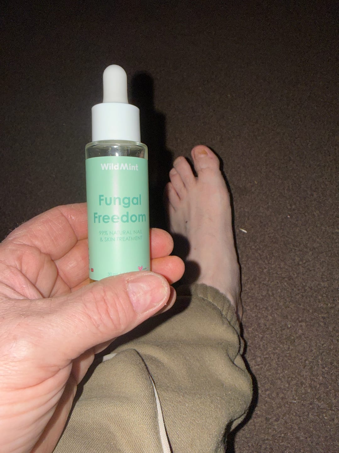 Customer photo review of Fungal Freedom