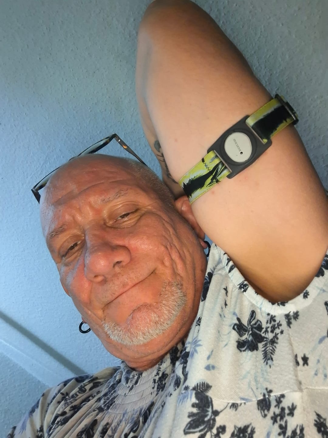 Customer photo review of Dexcom G7 Armband with Rotating Clip - Dia-Style Summer Edition