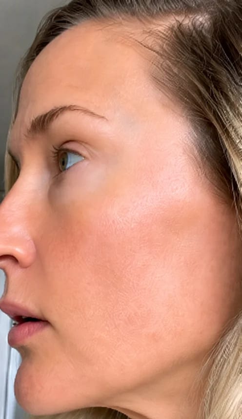 Customer photo review of Face Lift Massaggiatore Viso Lifting per lifting, Rassodante, Antirughe | Massaggiatore Viso Antirughe