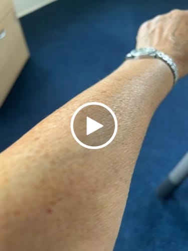 Customer photo review of Harvest & Hive™ Organic Tallow Balm - Made in the UK 🇬🇧
