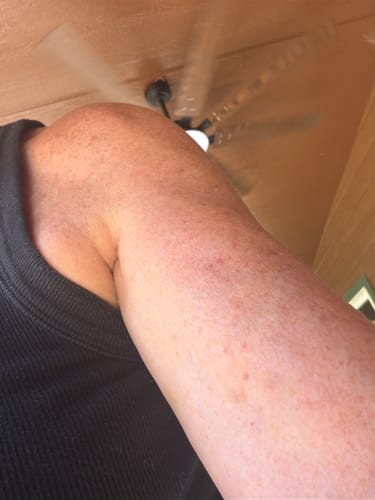 Customer photo review of NØRD BODY Peptide Body Oil (rev)