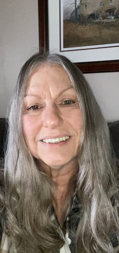 Reviewer showing their skin after using The Micro Infusion System to address fine lines.