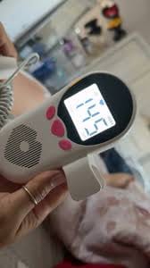 Customer photo review of BabyEcho Premium Doppler™