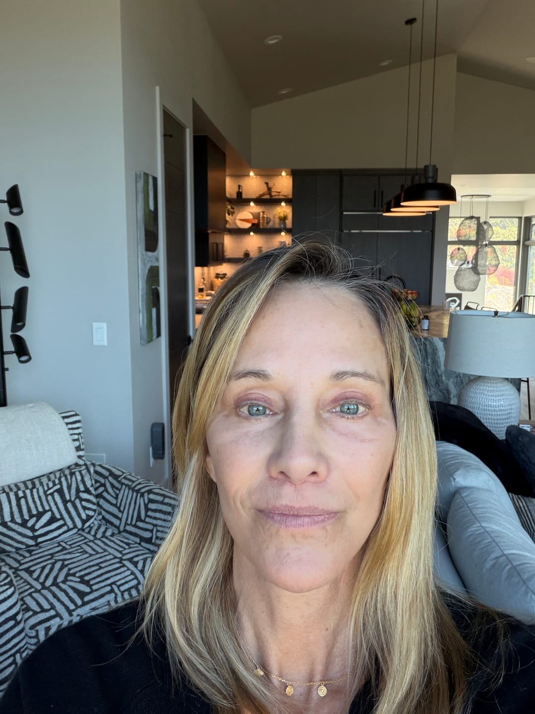 Customer photo review of 3% GHK-Cu Skin Cell Restorative Serum (50% More GHK-Cu)