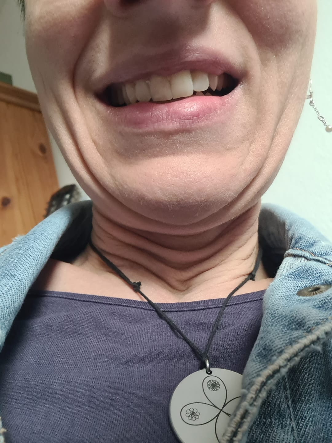Customer photo review of Omega-3 Algenöl (100ml)