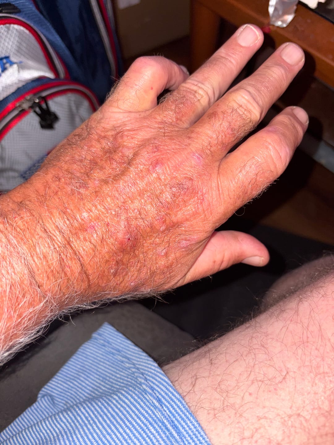 Customer photo review of Peanuts Snoopy Swing Glove