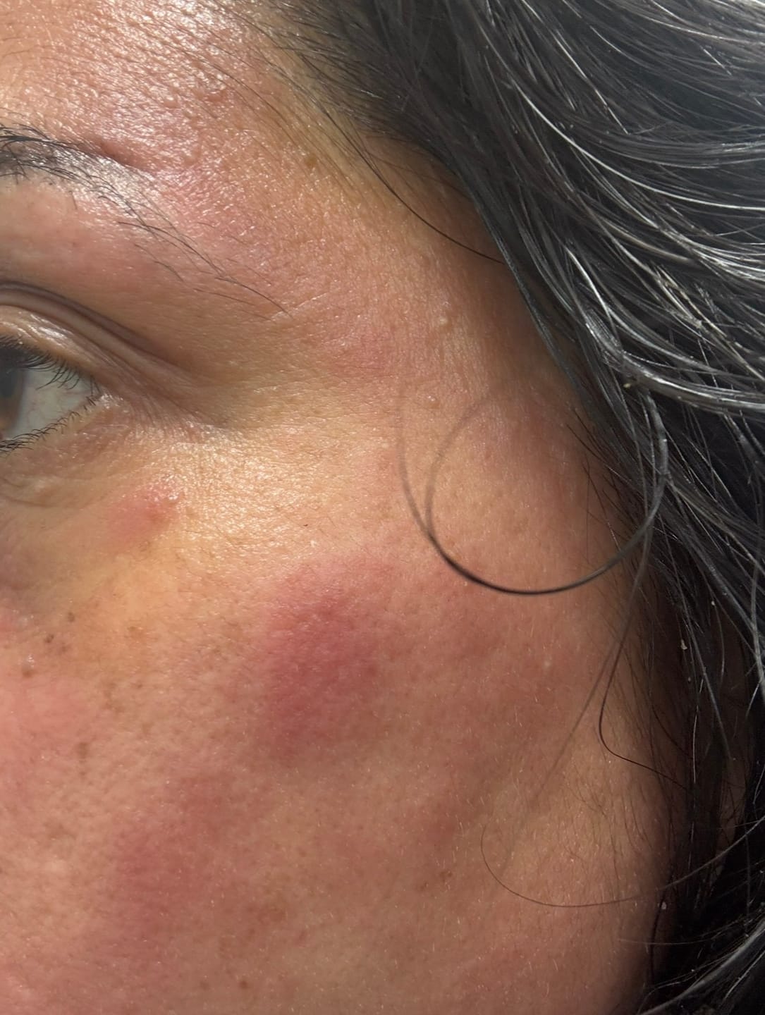Customer photo review of Seb Natural Calming Serum