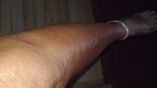 Customer photo review of NØRD BODY Peptide Body Oil (rev)