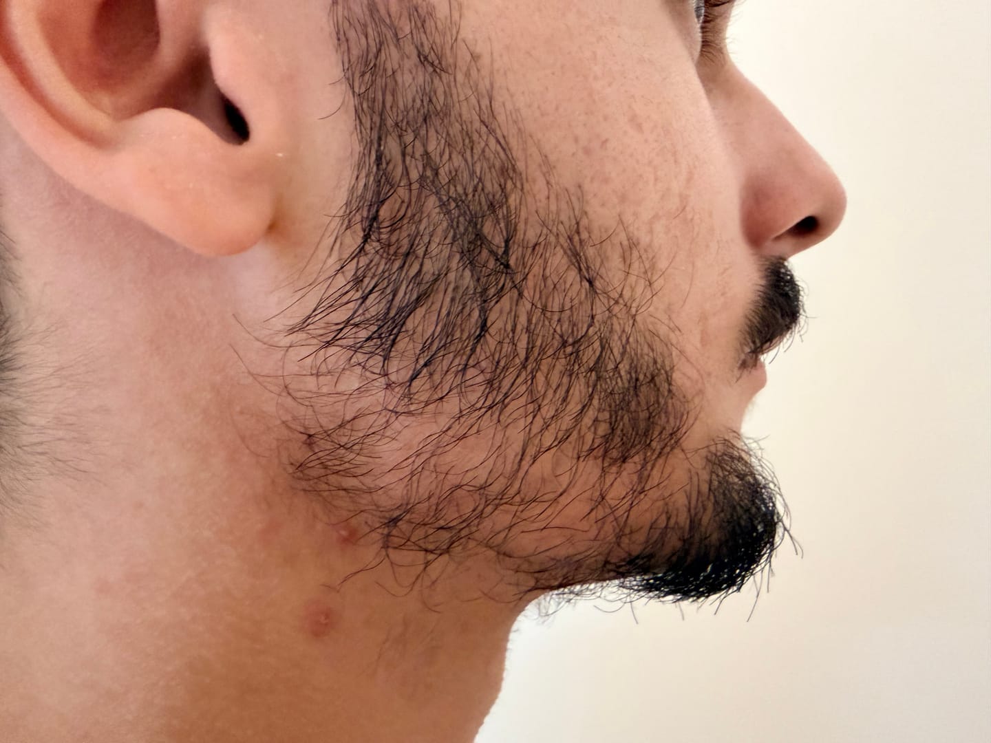 Customer photo review of Kit Pousse Barbe Complet | Coffret Viking