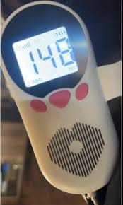 Customer photo review of BabyEcho Premium Doppler™