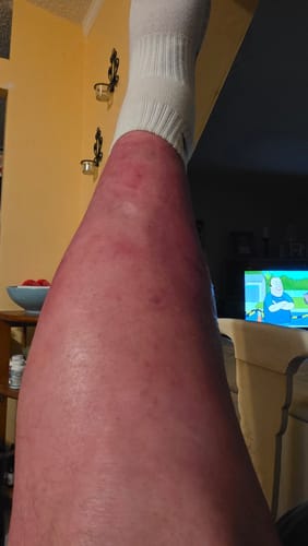Customer photo review of Buy 2, Get 1 FREE Lymflotion