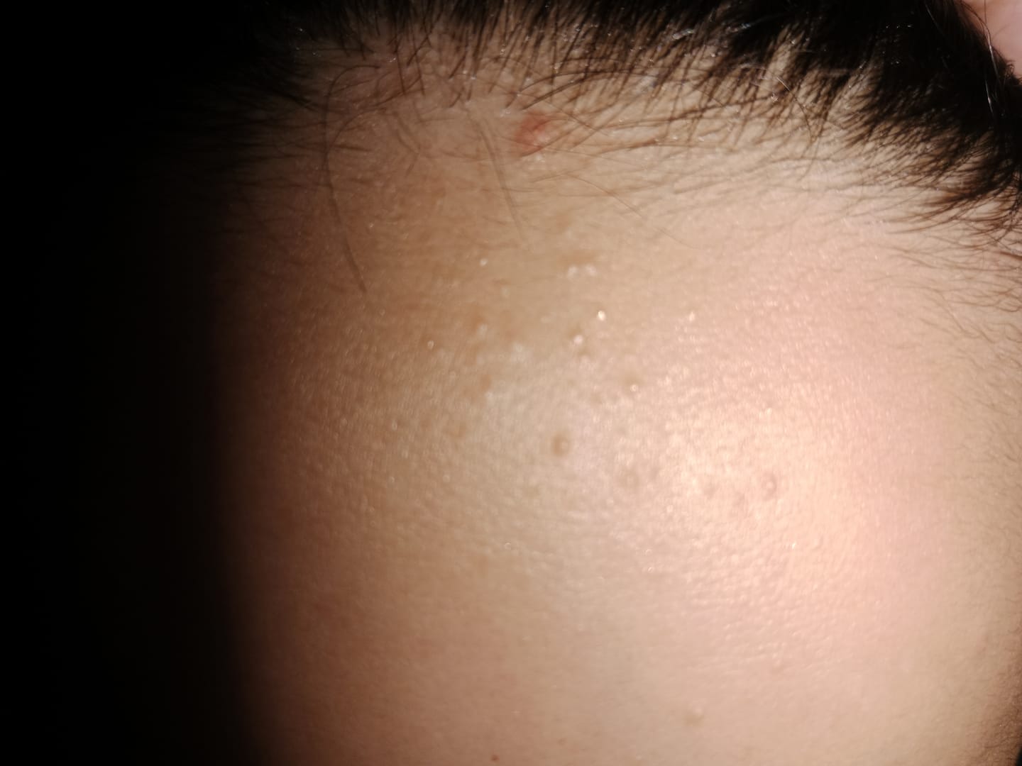 Customer photo review of LuminaBright Whitening Face Wash