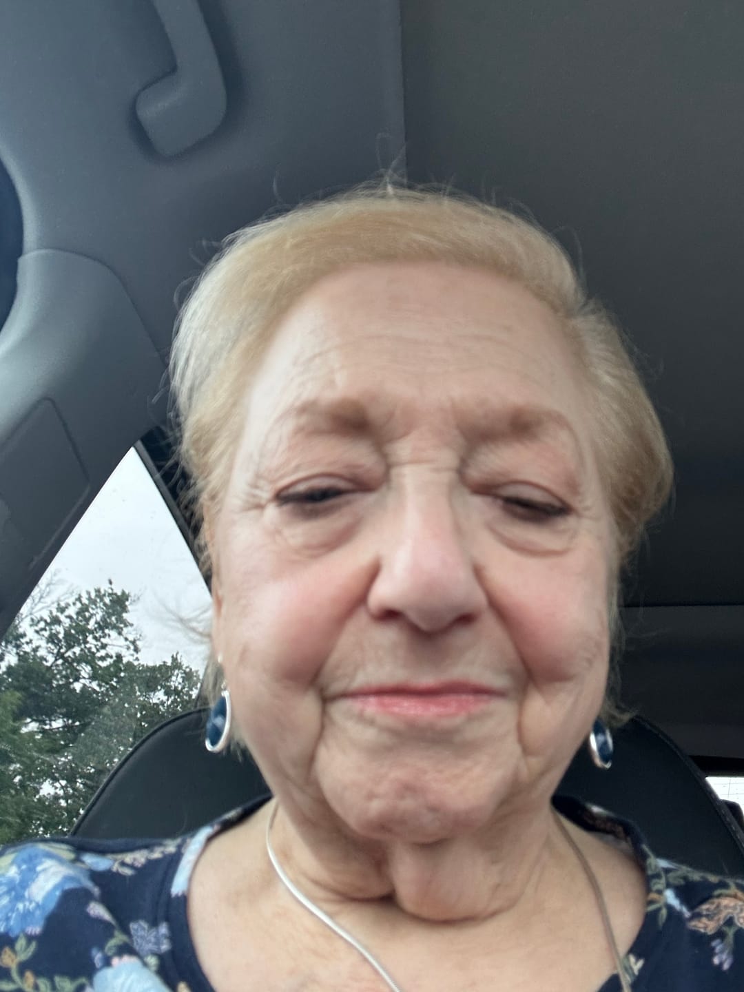 Customer photo review of ACTIVE PRO SERUM | ANTI-AGING