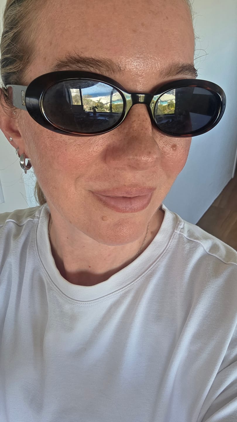 Customer photo review of Dot The Freckle Pen