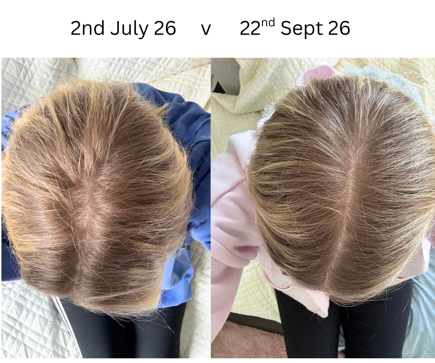 Customer photo review of Inner Youth Collagen + Mushroom Gummies