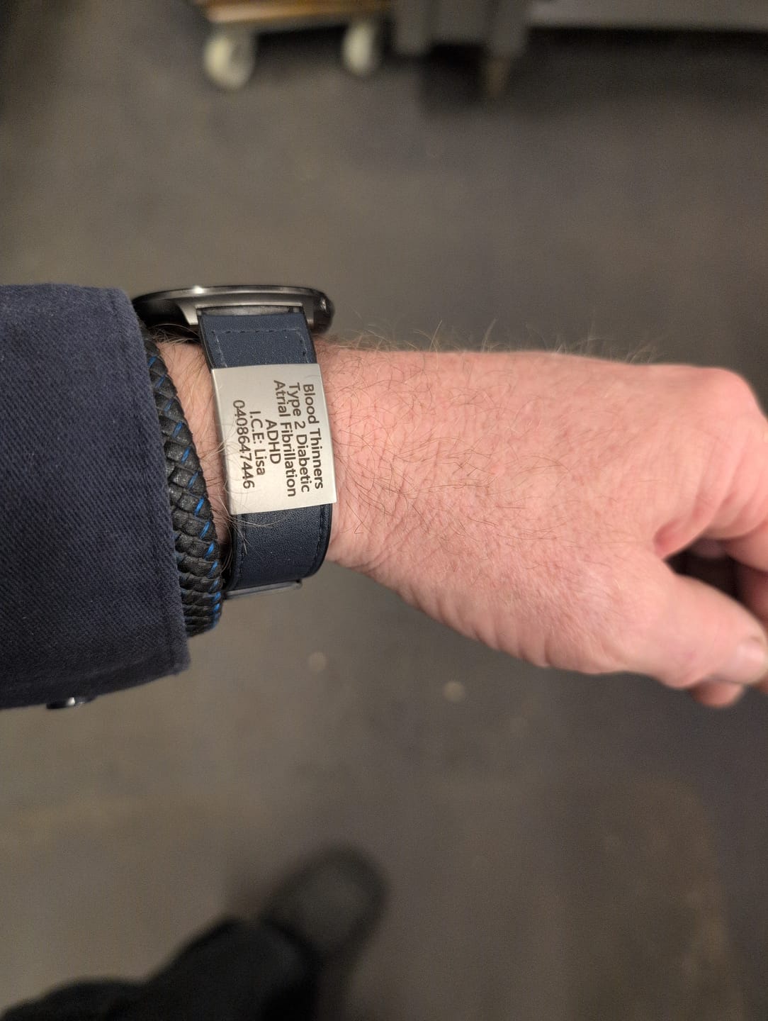 Customer photo review of Personalised ID Tag for Watch Band & Fitness Trackers