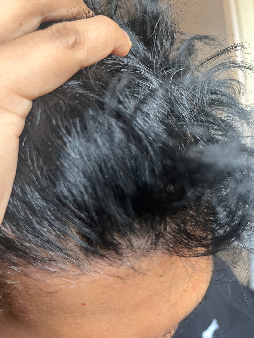 Customer photo review of Seb Natural Calming Serum