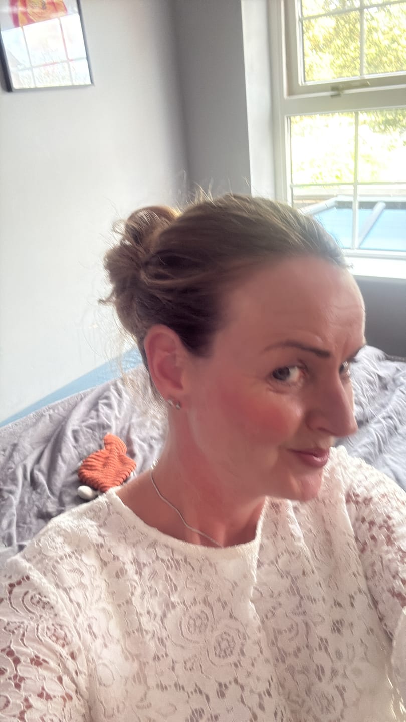 Customer photo review of Rosalique 3 in 1 Anti-Redness Miracle Formula SPF50