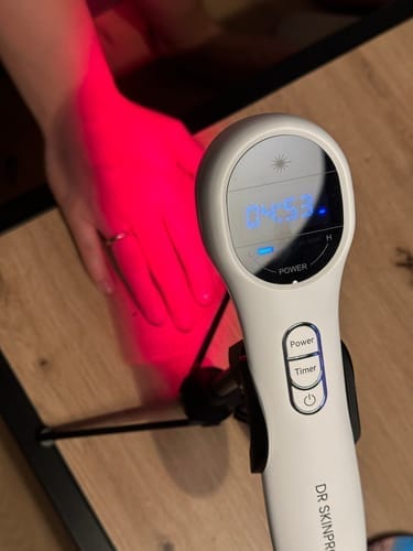 Customer photo review of DR SKINPRO® – Laserhalterung