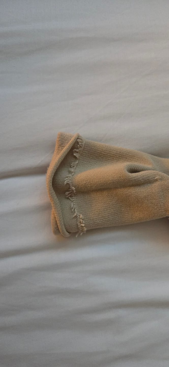 Customer photo review of EverSock™ Bamboo Open Toe Compression Socks