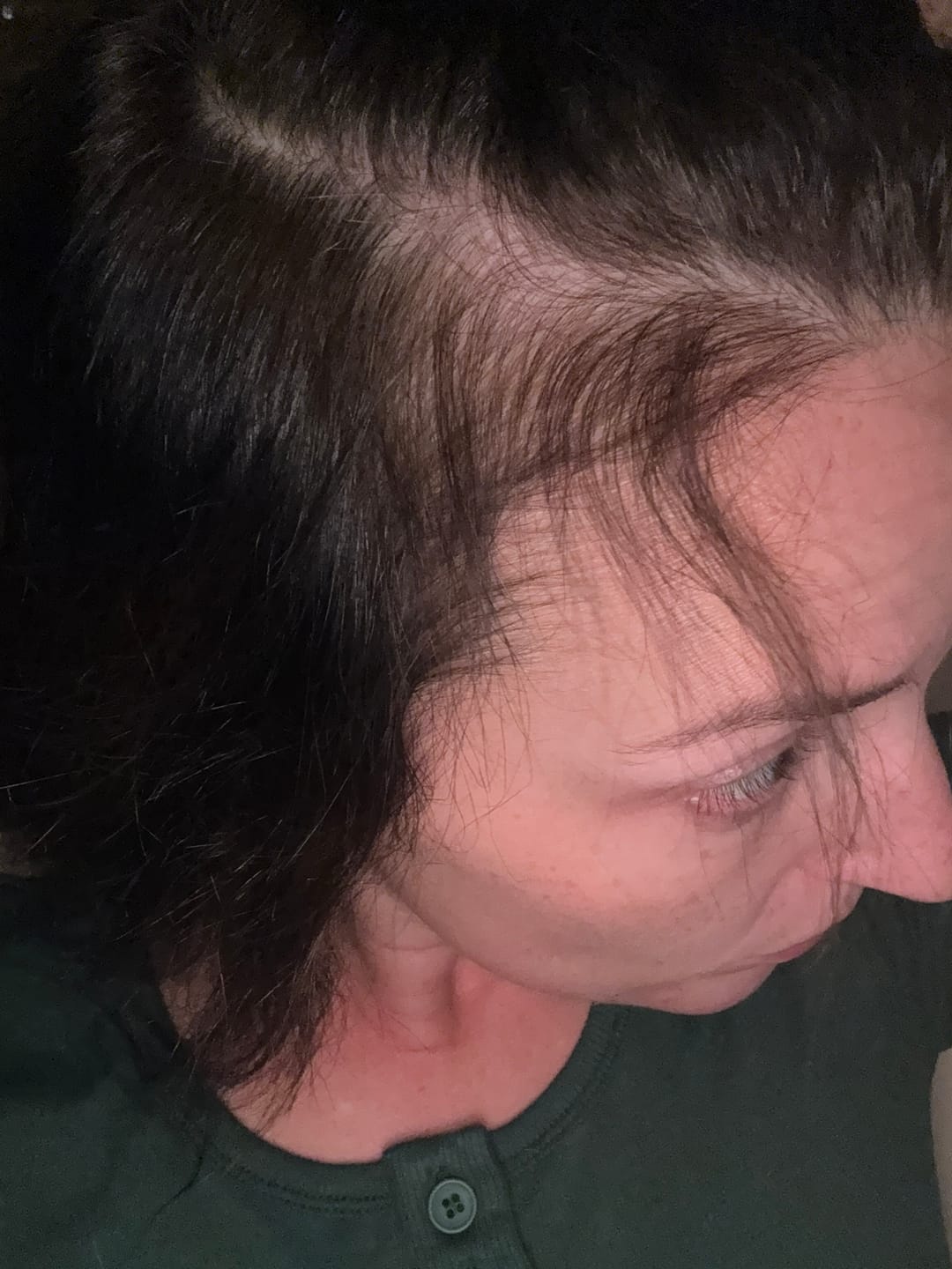 Customer photo review of Hair Growth Serum