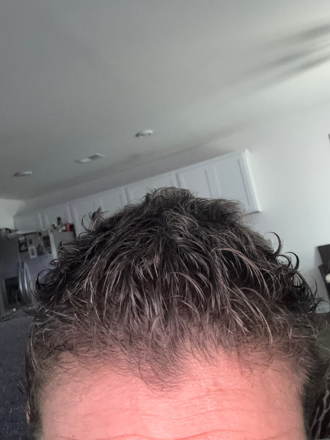 Customer photo review of Hair Growth Spray- Soothing Scalp Formula