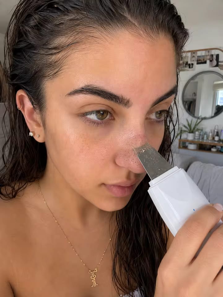 Customer photo review of Smoova™ — Ultrasonic Facial Cleanser 2.0