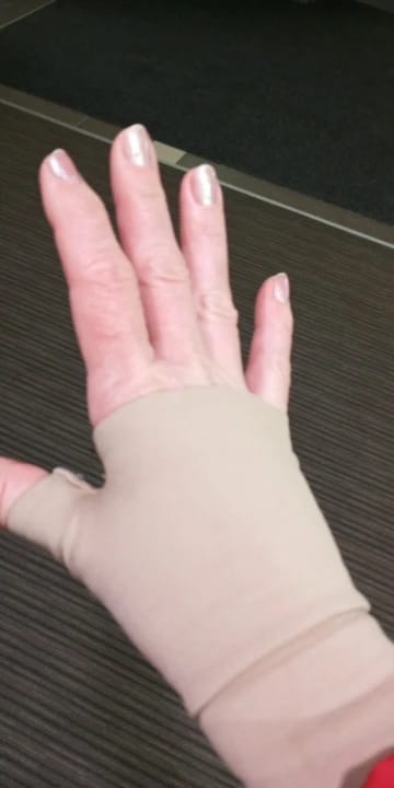 Customer photo review of The Thumb Stabilizer