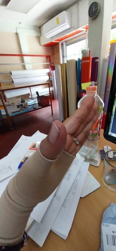 Customer photo review of The Thumb Stabilizer