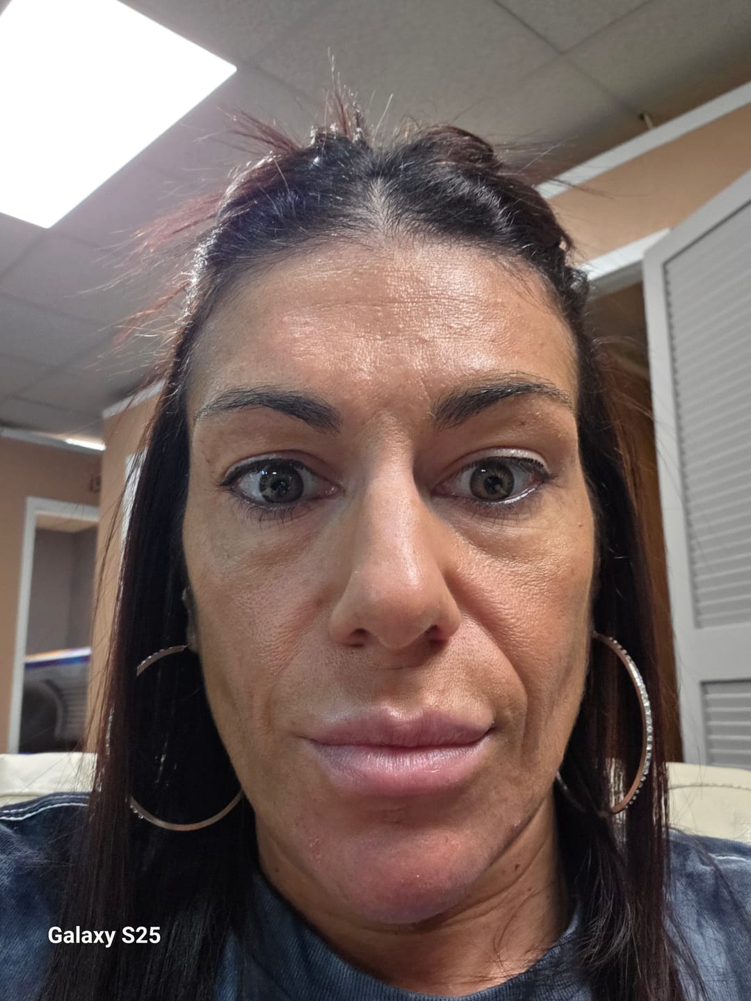Customer photo review of Hidrocor AVELA Brown Prescription Colored Contact Lenses