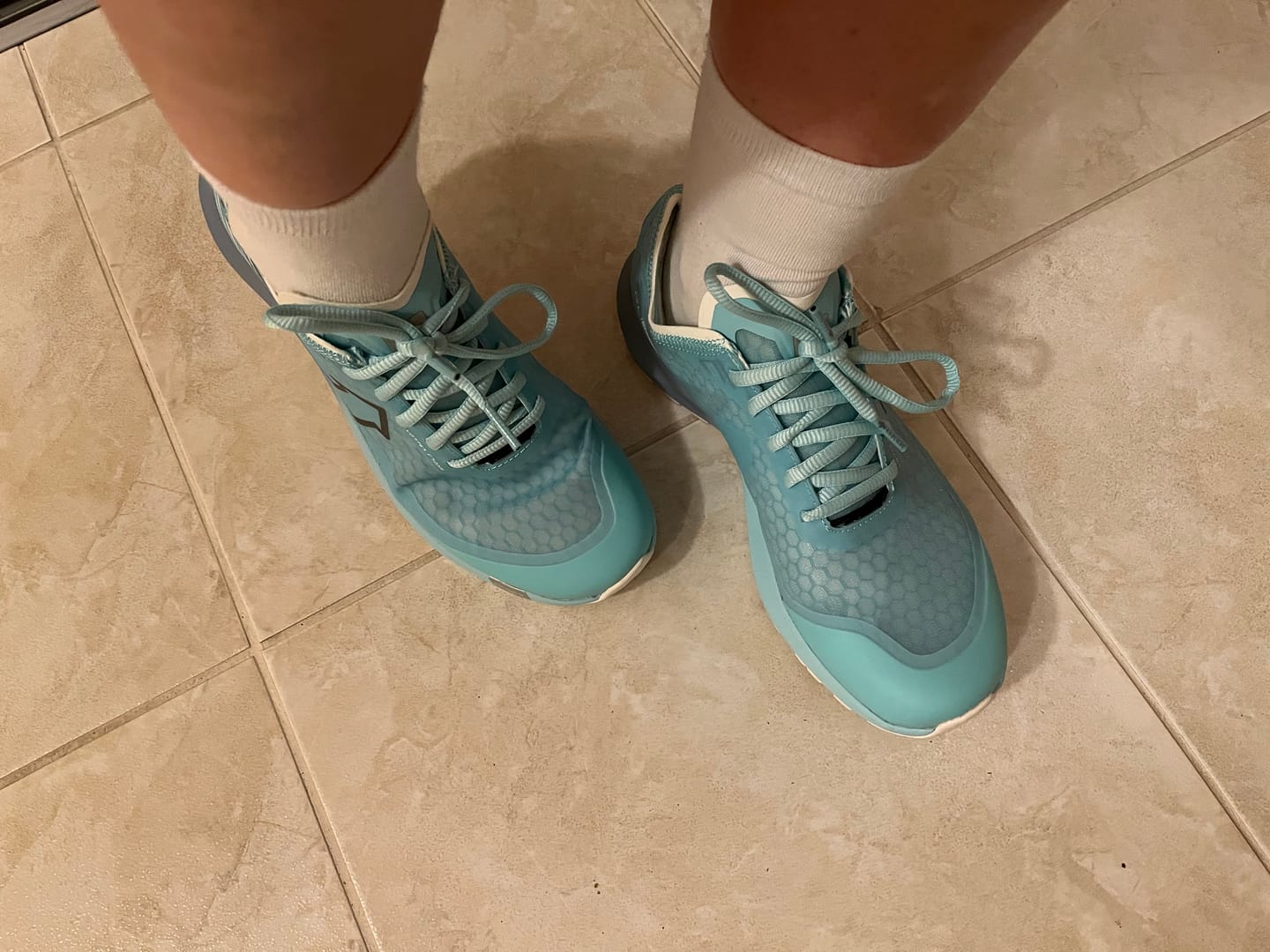 Customer photo review of XP 2.0