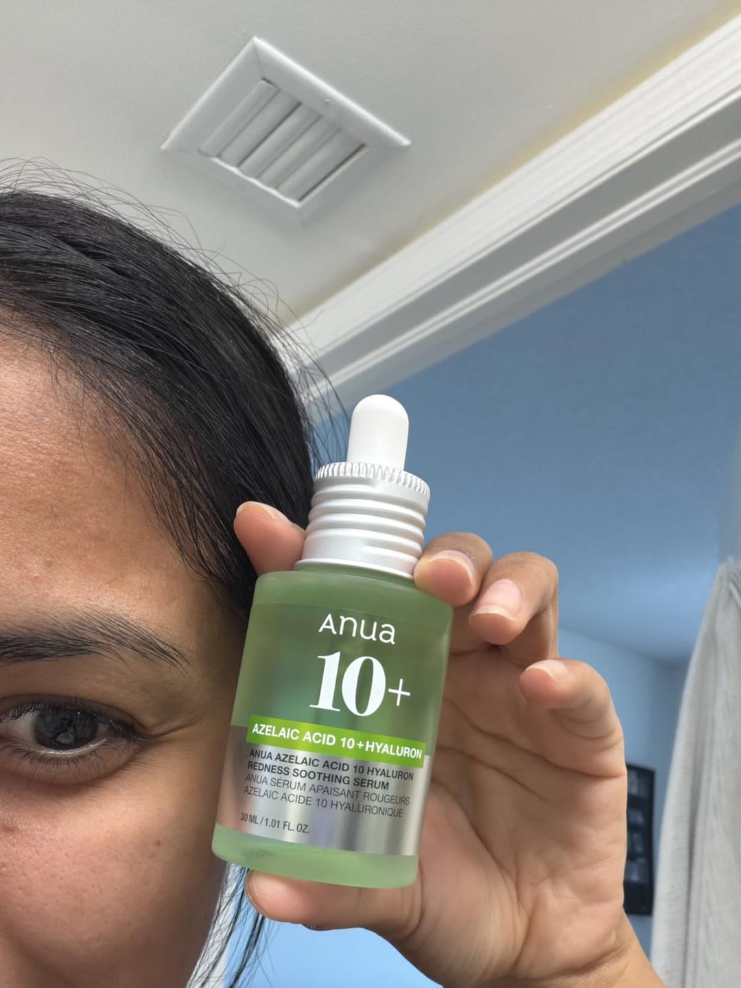 Customer photo review of Anua - Azelaic Acid 10 + Hyaluron Redness Soothing Serum
