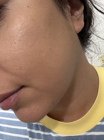 Customer photo review of Supreme Skin Set