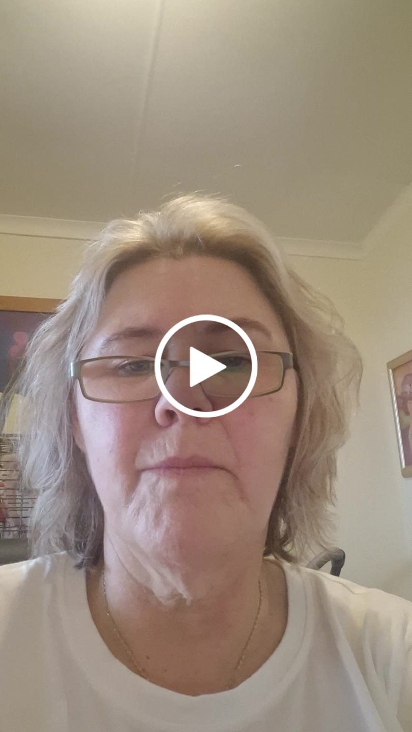 Customer video review of Biosense Biotin 5000mcg Hair Treatment - Anti Hair Loss Supplement