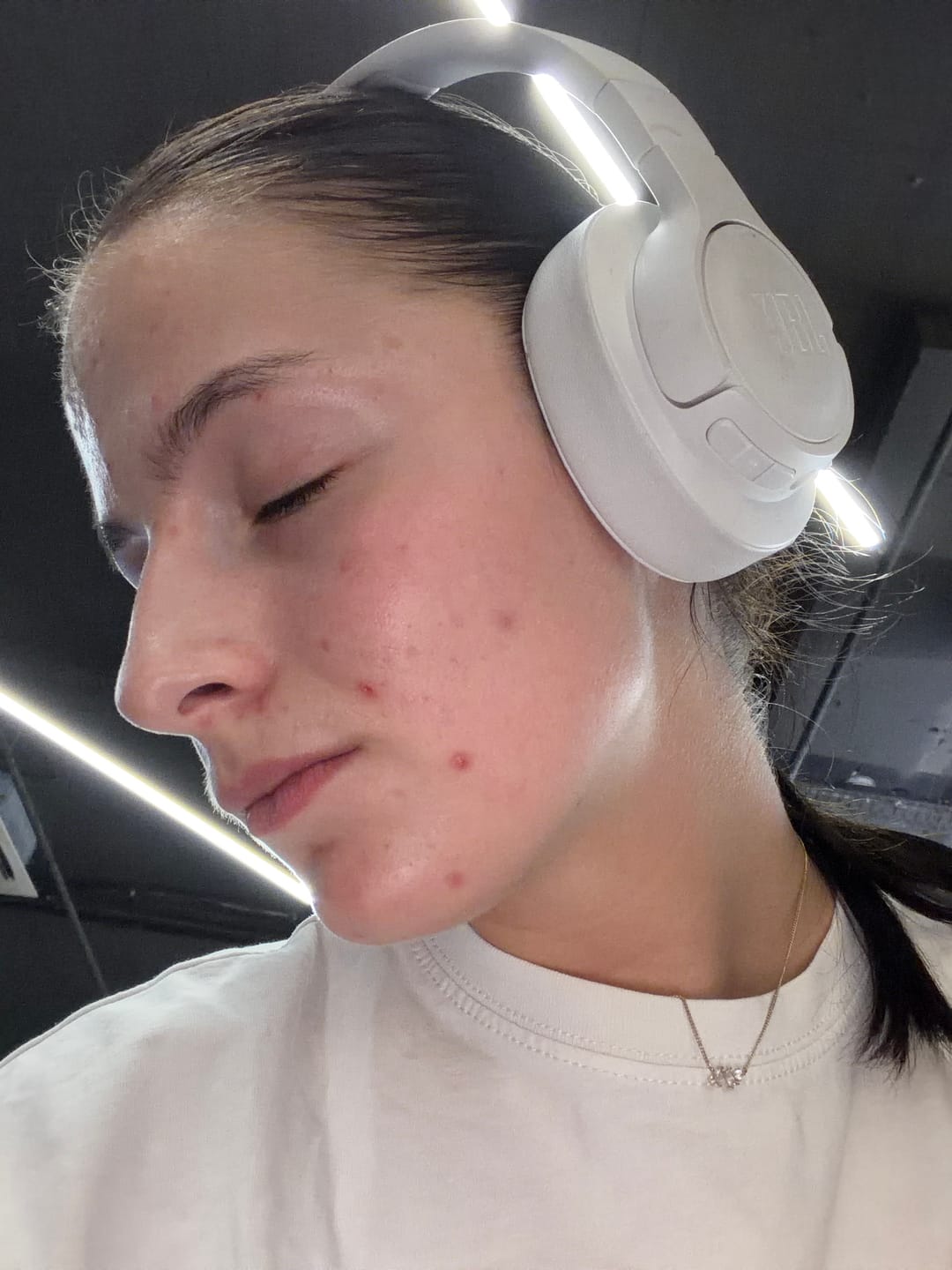 Customer photo review of pHformula MD AC RINKINYS RIEBIAI ODAI