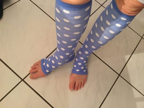 Customer's zehenfreie FlowFit Kompressionssocken in Blau mit weißen Punkten an den Füßen getragen.