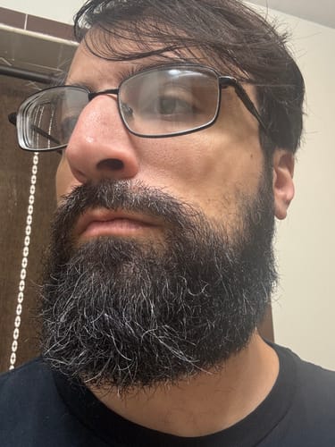 Customer photo review of Beard Oil for Men – Natural, Fast-Absorbing, 1oz