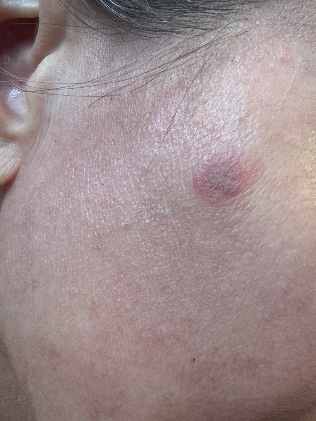 Customer photo review of INIA GLOW Neck & Chest Red Light Therapy