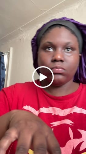 Customer photo review of Collagen Jelly Cream with Niacinamide