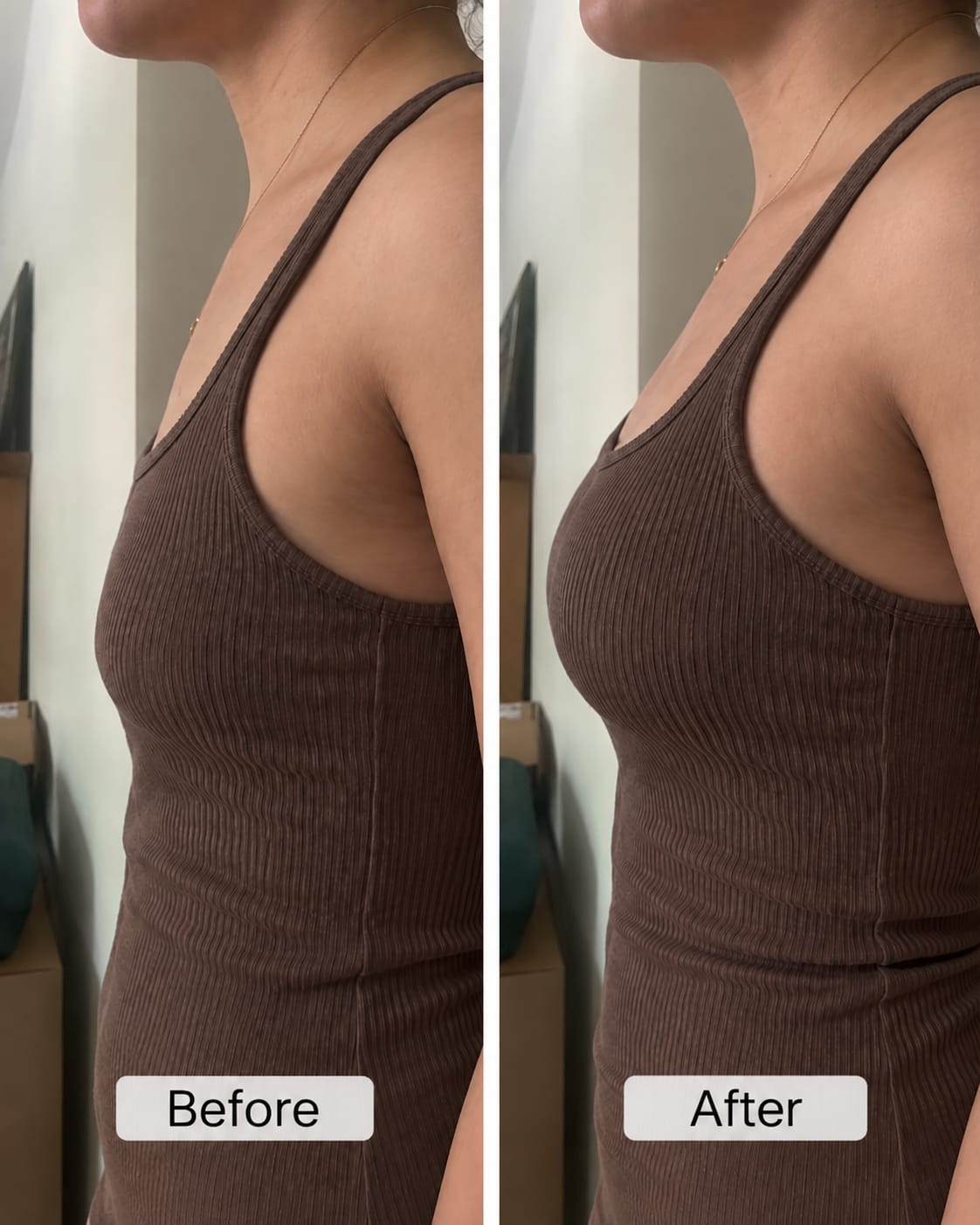 Customer photo review of Stick On Bra