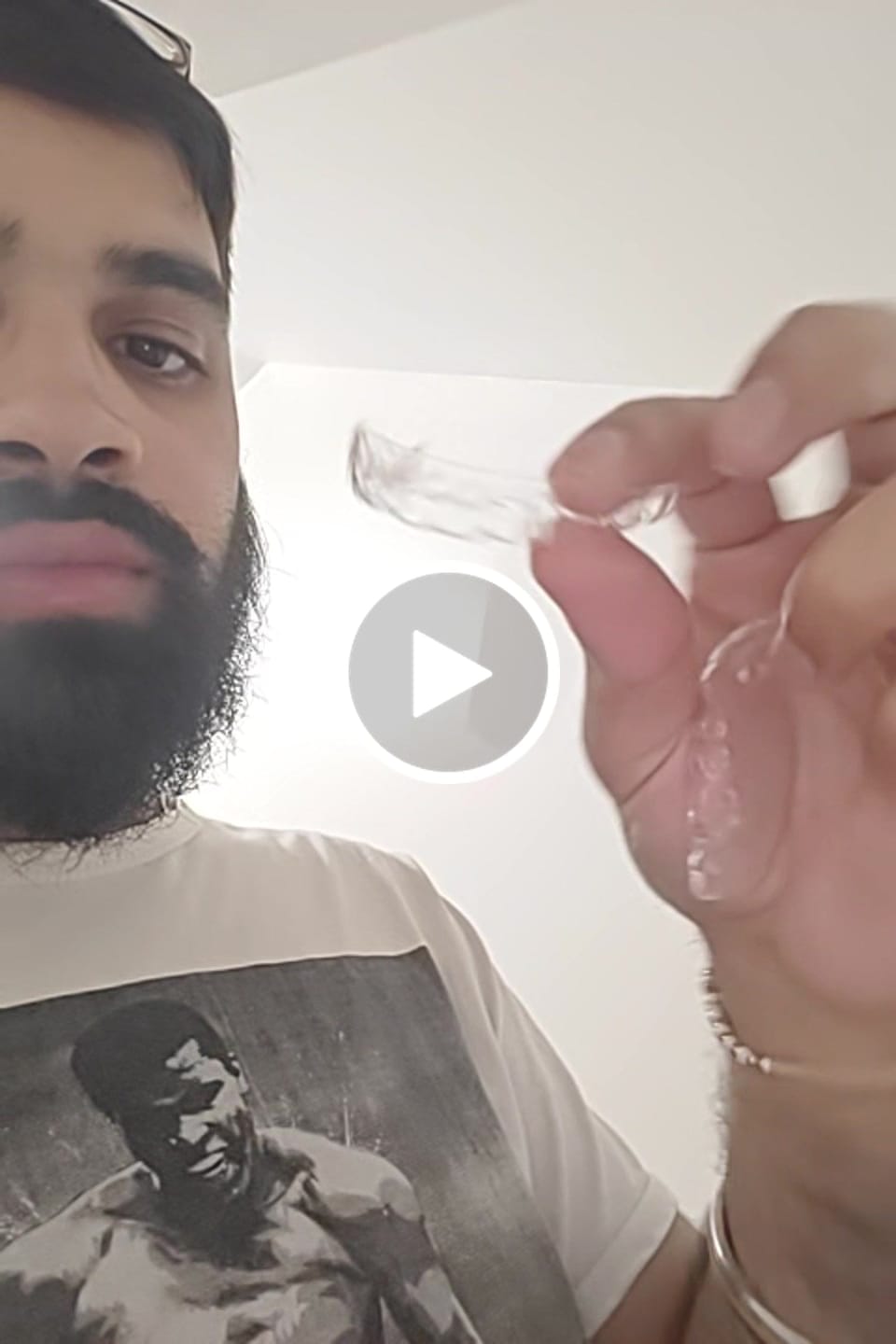 Customer video review of Essix Retainers