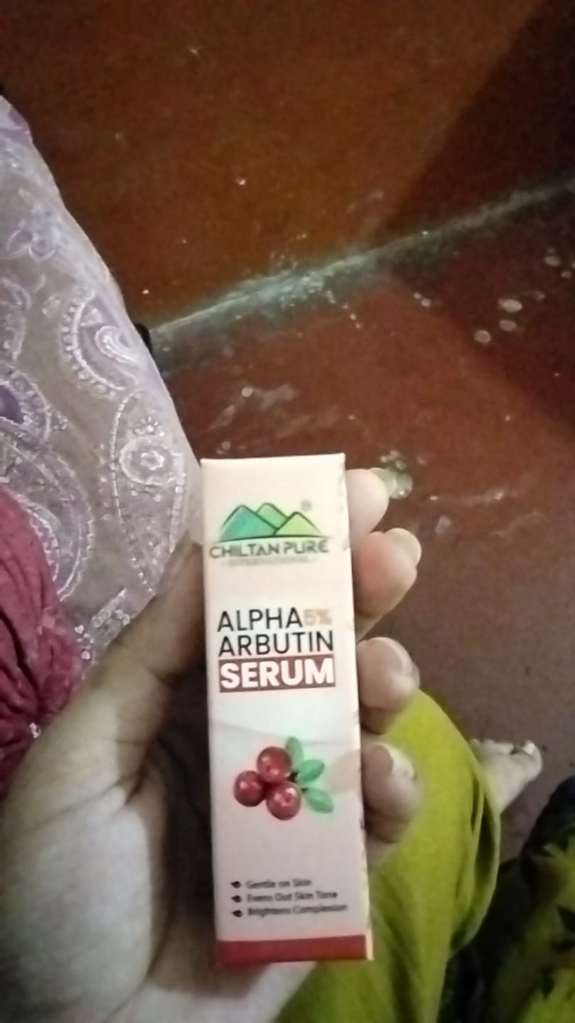 Customer photo review of ALPHA ARBUTIN SERUM - To Gentle On Skin , Even Out Of Skin Tone & Brighten Complexion