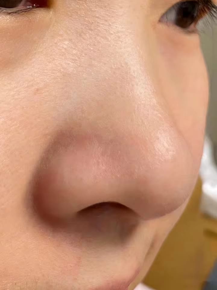 Customer photo review of Smoova™ — Ultrasonic Facial Cleanser 2.0
