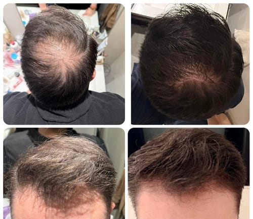 Customer photo review of HENRIC X5