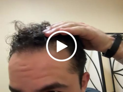 Customer photo review of HENRIC X5