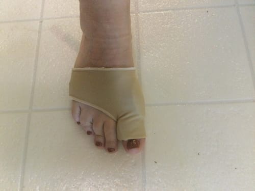 Customer photo review of BareRelief Guard