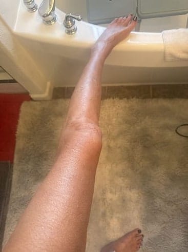 Customer photo review of Exfoliating Body Prep Wash