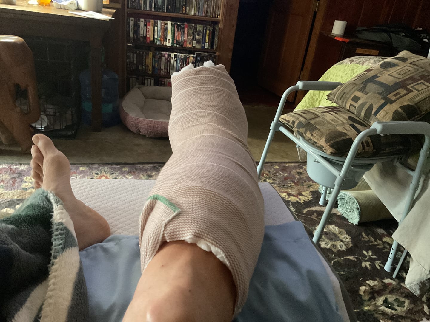 Customer photo review of Premium Anti-Fatigue Bamboo Footsleeves