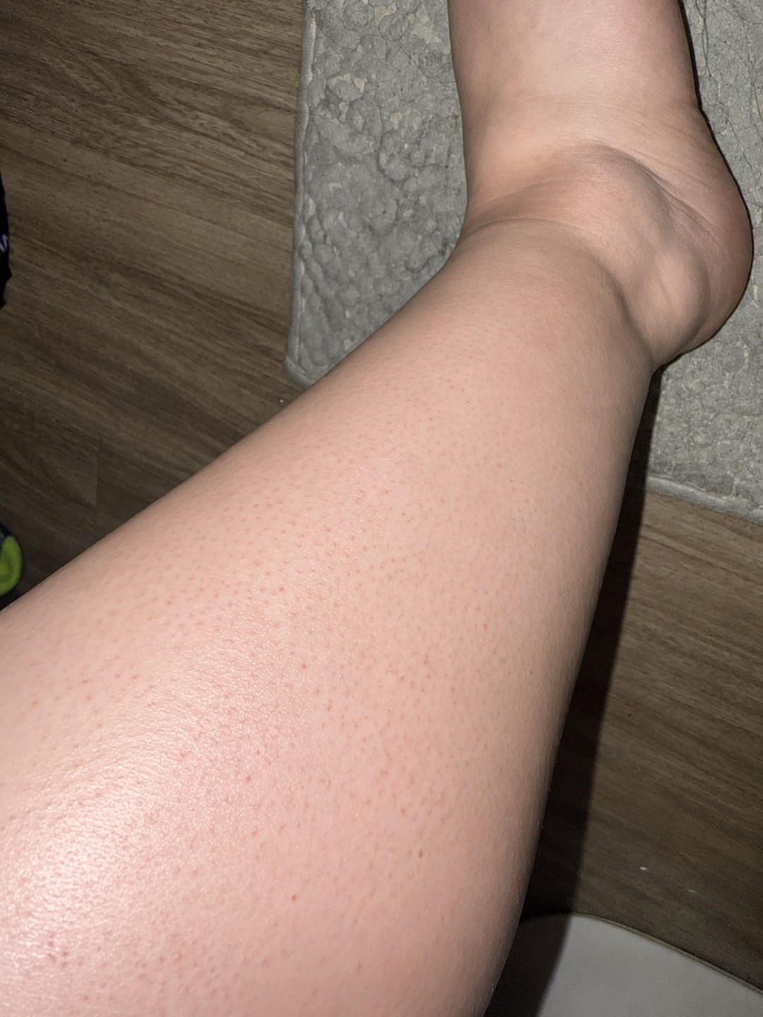 Customer photo review of CloudSense Pain-Free Hair Removal Foam Spray